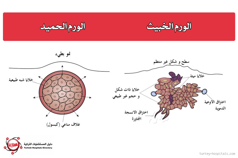 هل الورم السرطاني يكبر حجمه؟