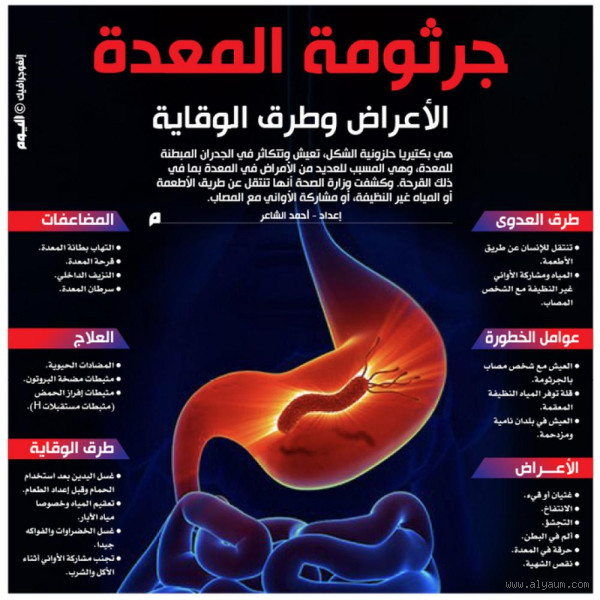 أين يكون ألم جرثومة المعدة؟ لا تتجاهل هذا الوجع المزعج